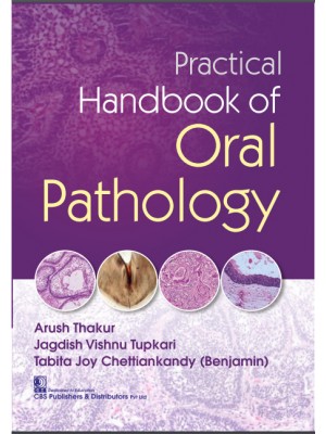 Practical Handbook of Oral Pathology (PB)