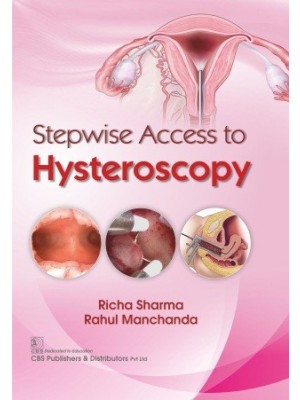 Stepwise Access to Hysteroscopy (HB)