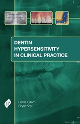 Dentin Hypersensitivity in Clinical Practice (POD) 1/e