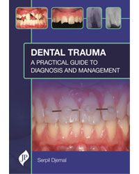 Dental Trauma: A Practical Guide to Diagnosis and Management 1/e