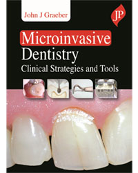 Microinvasive Dentistry: Clinical Strategies and Tools 1/e