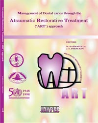 Management of Dental Caries Through the Atraumatic Restorative Treatment (ART) Approach 1/e