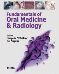 Fundamentals of Oral Medicine and Radiology 1/e