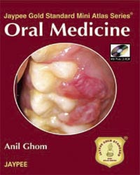 Jaypee Gold Standard Mini Atlas Series Oral Medicine with Photo CD-ROM 1/e