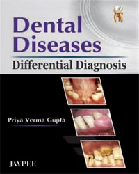 Dental Diseases Differential Diagnosis  1/e