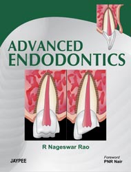Advanced Endodontics 1/e