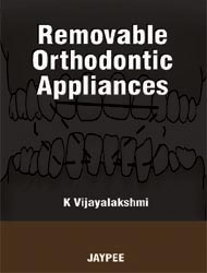 Removable Orthodontic Appliances 1/e