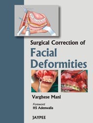 Surgical Correction of Facial Deformities 1/e