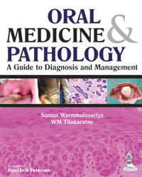 Oral Medicine and Pathology: A Guide to Diagnosis and Management  1/e