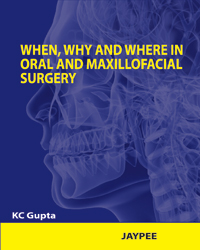 When, Why and Where in Oral and Maxillofacial Surgery 1/e
