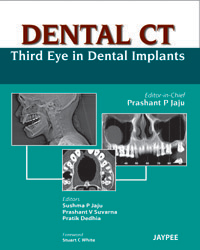 Dental CT: Third Eye in Dental Implants 1/e