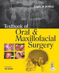 Textbook of Oral and Maxillofacial Surgery 1/e
