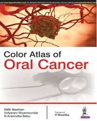 Color Atlas of Oral Cancer  1/e