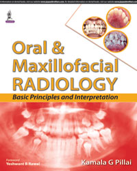 Oral and Maxillofacial Radiology: Basic Principles and Interpretation 1/e