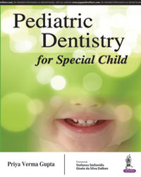 Pediatric Dentistry for Special Child 1/e