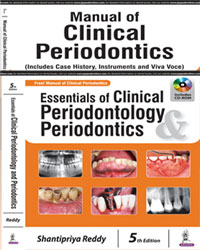 Essentials of Clinical Periodontology and Periodontics with Supplementary Manual of Clinical Periodontics (with Interactive DVD-ROM) 5/e