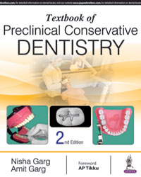 Textbook of Preclinical Conservative Dentistry 2/e
