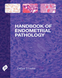 Handbook of Endometrial Pathology|1/e