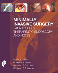 Minimally Invasive Surgery|1/e