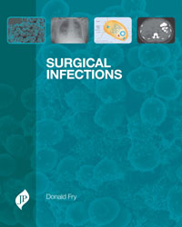 Surgical Infections|1/e