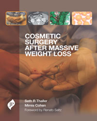 Cosmetic Surgery after Massive Weight Loss|1/e