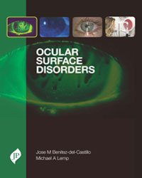 Ocular Surface Disorders|1/e