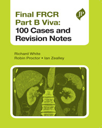 Final FRCR Part B Viva 100 Cases and Revision Notes|1/e