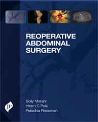 Reoperative Abdominal Surgery|1/e