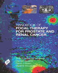 Handbook of Focal Therapy for Prostate and Renal Cancer|1/e