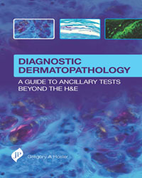 Diagnostic Dermatopathology: A Guide to Ancillary Tests Beyond the H&E|1/e