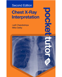 Pocket Tutor Chest X-Ray Interpretation|2/e