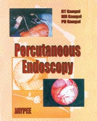 Percutaneous Endoscopy|1/e