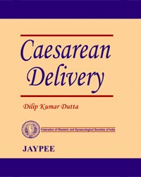 Caesarean Delivery (FOGSI)|1/e (Reprint)