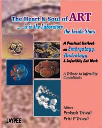 The Heart and Soul of ART|1/e