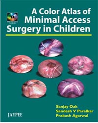 A Color Atlas of Minimal Access Surgery in Children (with CD-ROM)|1/e