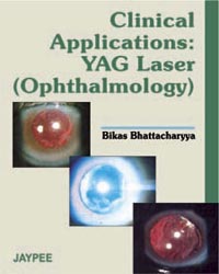 Clinical Application YAG Laser (Ophthalmology)|1/e