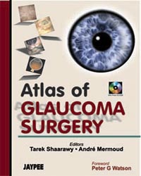 Atlas of Glaucoma Surgery with Photo CD-ROM (Complete Book Available in PDF Format)|1/e
