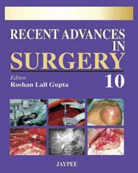 Recent Advances in Surgery  (Vol-10)|1/e