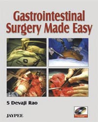 Gastrointestinal Surgery Made Easy with 2 CD-ROMs|1/e