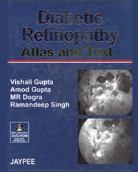 Diabetic Retinopathy: Atlas and Text (with DVD-ROM)|1/e