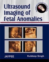 Ultrasound Imaging of Fetal Anomalies(Dr Kuldeep's Obstetric Sonology Series)|1/e