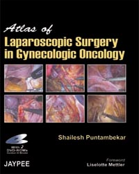 Atlas of Laparoscopic Surgery in Gynecologic Oncology with 2 DVD-ROMs|1/e