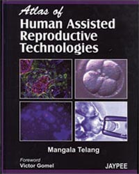 Atlas of Human Assisted Reproductive Technologies|1/e