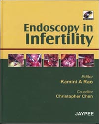 Endoscopy in Infertility (with DVD-ROM)|1/e