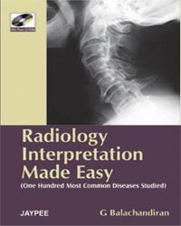 Radiology Interpretation Made Easy (with Photo CD ROM)|1/e