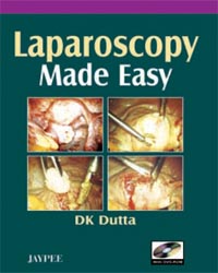 Laparoscopy Made Easy with DVD-ROM|1/e