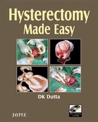 Hysterectomy Made Easy with CD-ROM|1/e