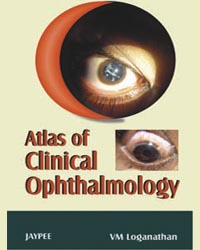 Atlas of Clinical Ophthalmology|1/e