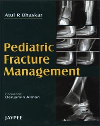 Pediatric Fracture Management|1/e