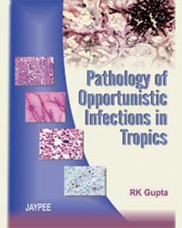 Pathology of Opportunistic infections in Tropics|1/e